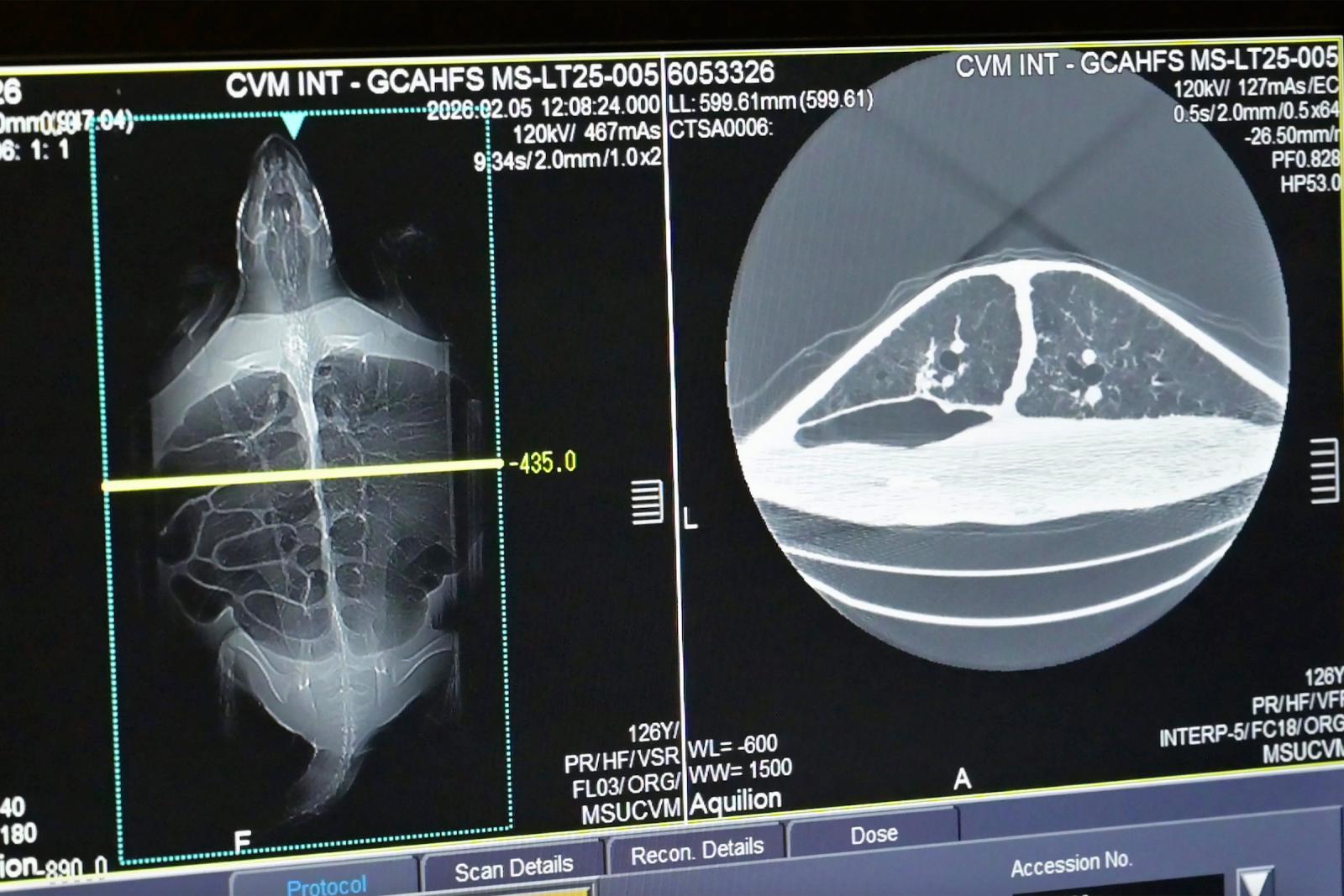 radiology scan